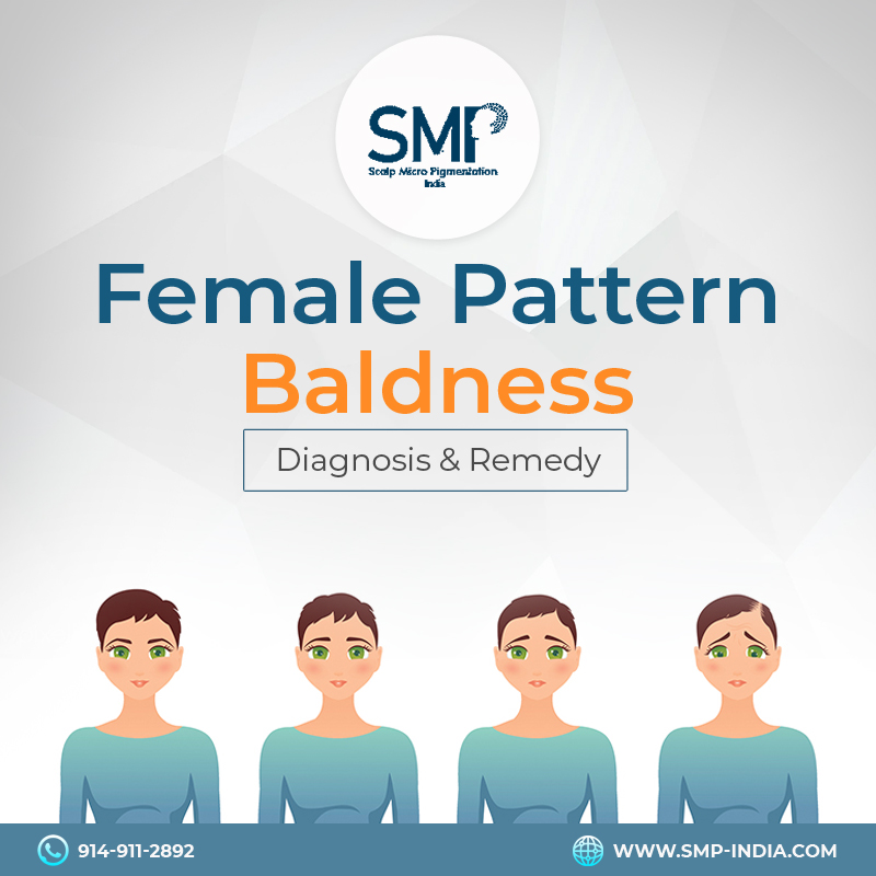 female-baldness-treatment
