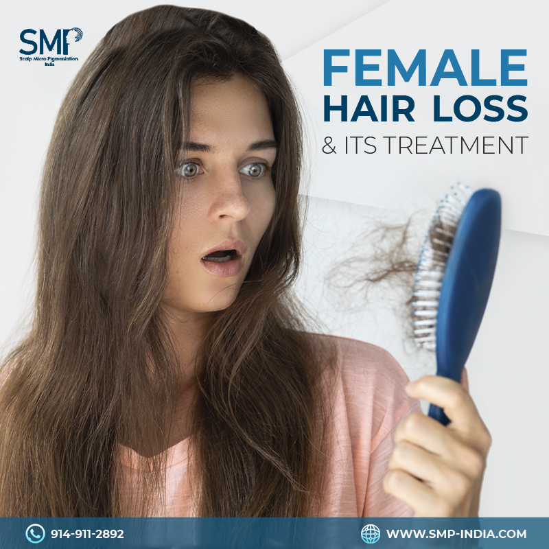 female-hair-loss-smp-india