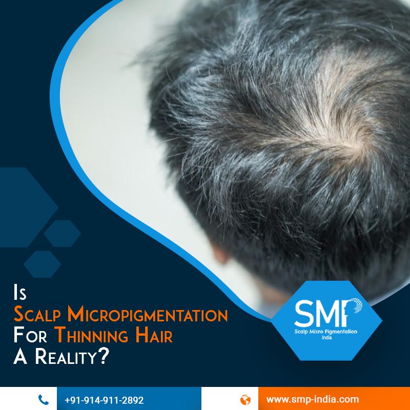 Scalp Micropigmentation for Thinning Hair a Reality